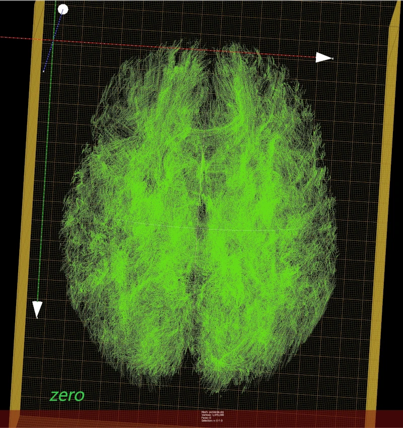 brain_pathways